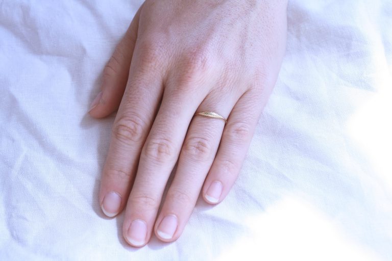 Etched Ovate II Ring